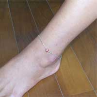 �A���N���b�g�E�V���o�[�v���[�g